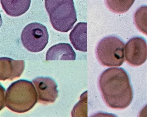  Plasmodium - En mikroskopisk parasit som invaderar röda blodkroppar och orsakar malaria!