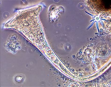  Drepanomonas - En fantastiskt virvelvind av ciliater med en unik förmåga att glida fram genom vatten!