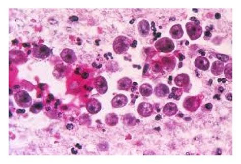  Naegleria Fowleri: En mikroskopisk mördare som simmar fritt i sötvatten och väntar på att invadera ditt centrala nervsystem!